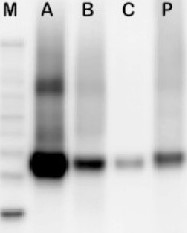 eEF1a | Elongation factor 1-alpha in the group Antibodies Plant/Algal  / DNA/RNA/Cell Cycle / Translation at Agrisera AB (Antibodies for research) (AS10 934)